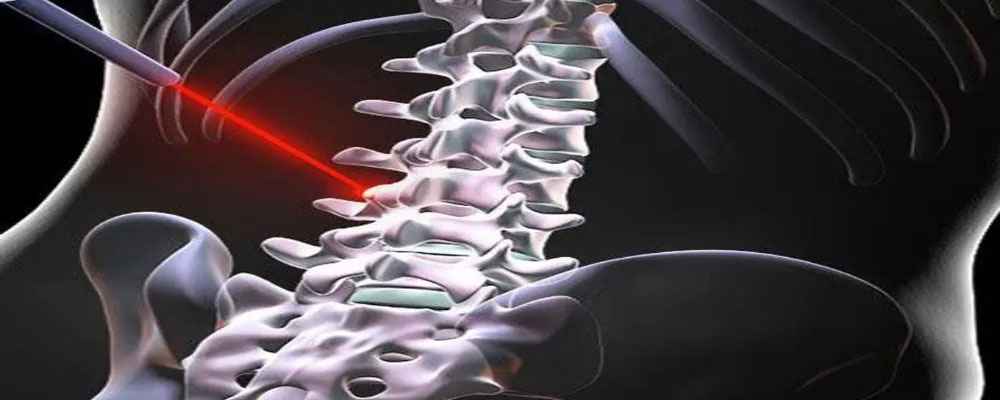 Spine Doctors in Hyderabad